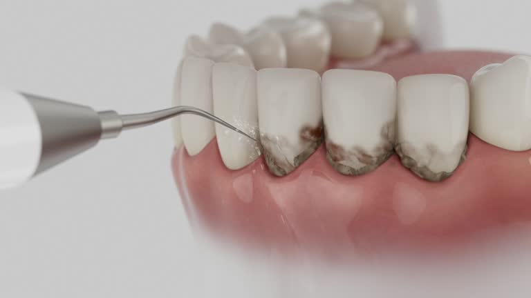 Reliable Dental Implants contractor in Nolanville, TX by Smile Center Dentistry